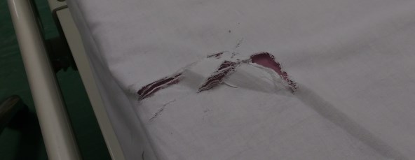 Torn sheet